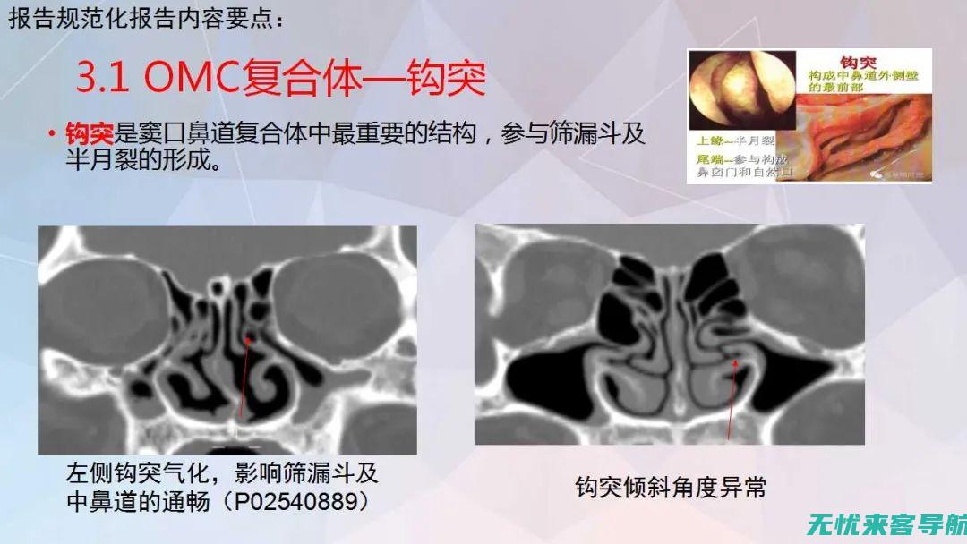 鼻窦炎症状评分表