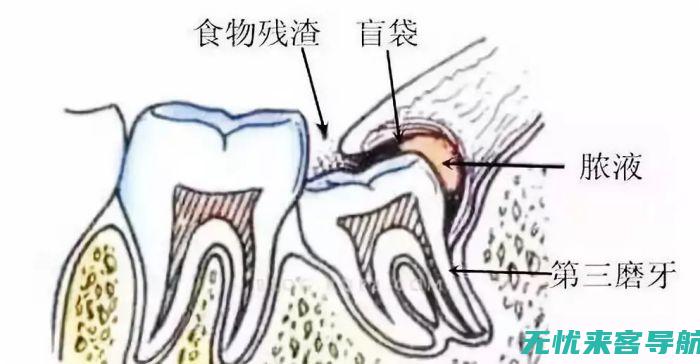 了解导致牙痛的常见原因及其措施