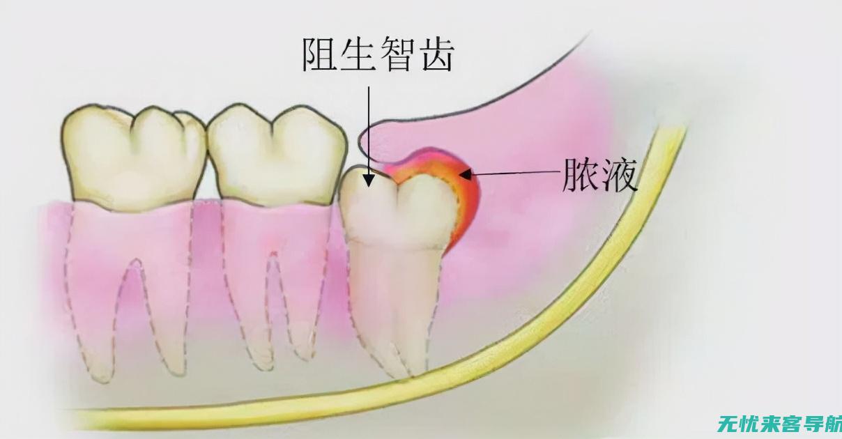 快速消炎的科学指南