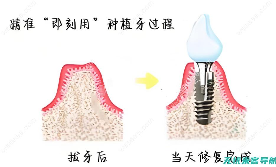 一分钟了解