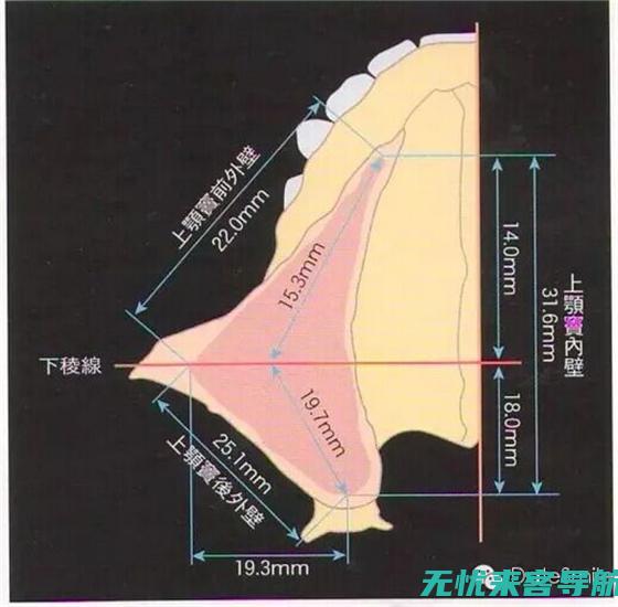 全面了解上颌窦炎