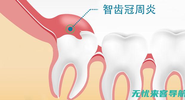 这些家庭护理技巧帮你轻松应对