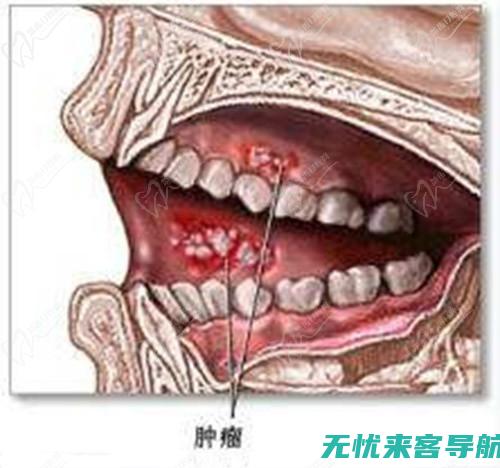 炎的早期三大症状