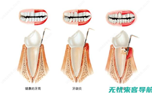 如何早期信号并采取有效治疗