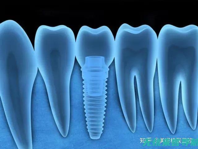 发炎肿痛与整体口腔健康的联系及长期解决方案