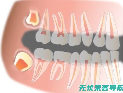 智齿发炎急救措施：科学饮食与抗炎食品推荐