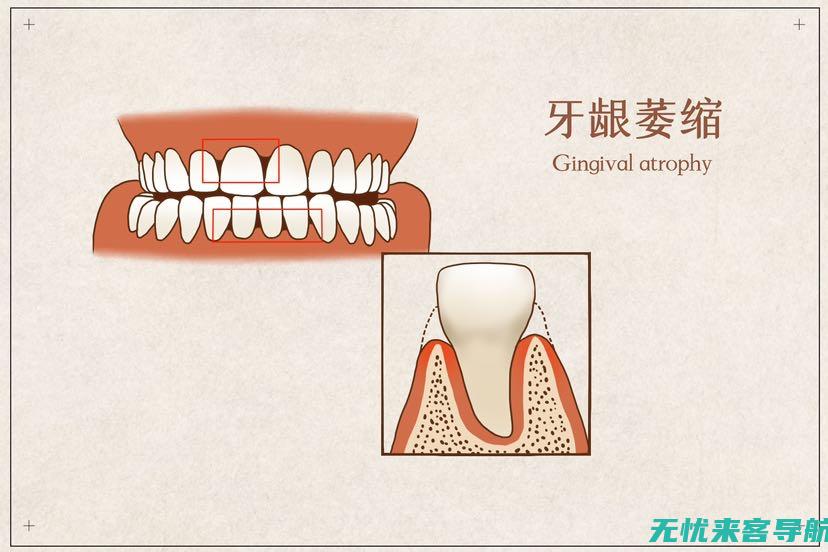 一招教你笑容