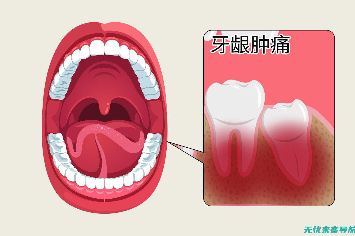 肿痛紧急止痛法