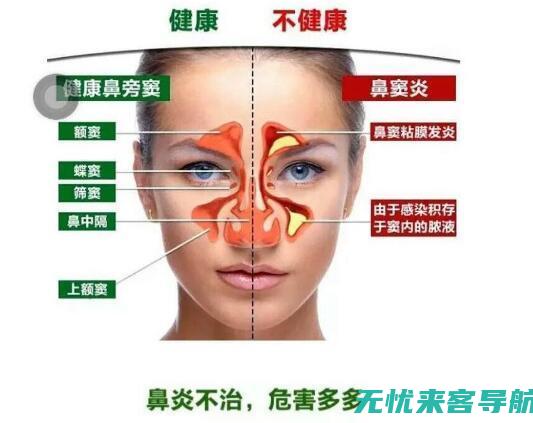 深入了解鼻窦炎