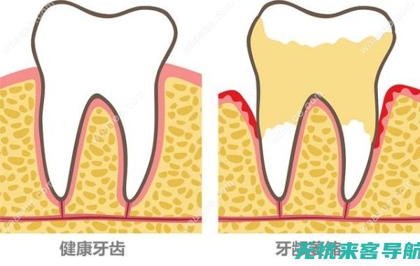 萎缩逆转怎么治疗