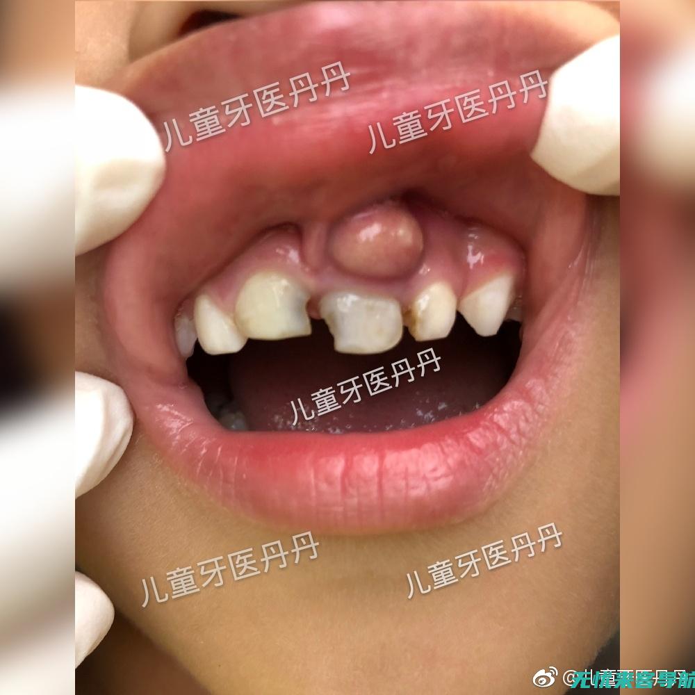 专家指导的口腔不适