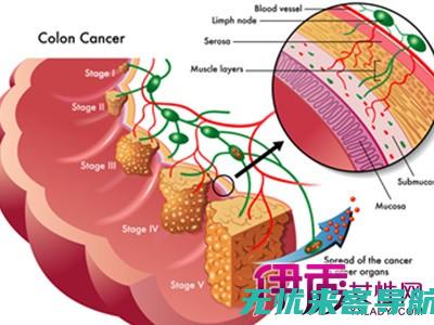 揭秘！对抗肠胃的五大食物选择