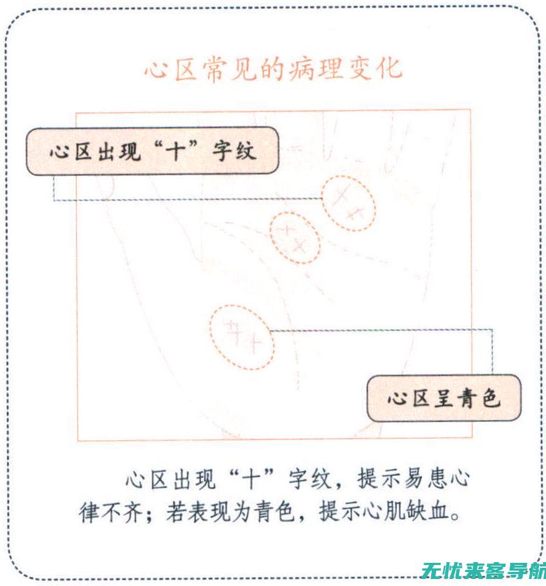 淋巴结炎症图集