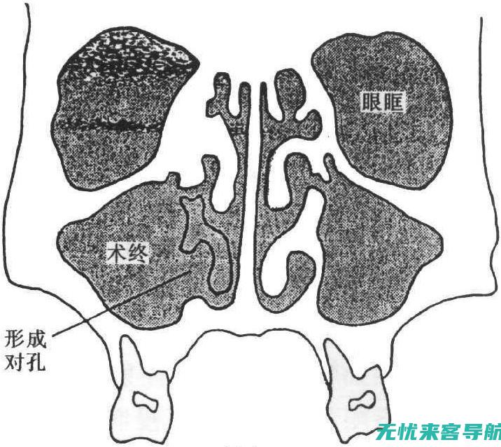 炎信号灯