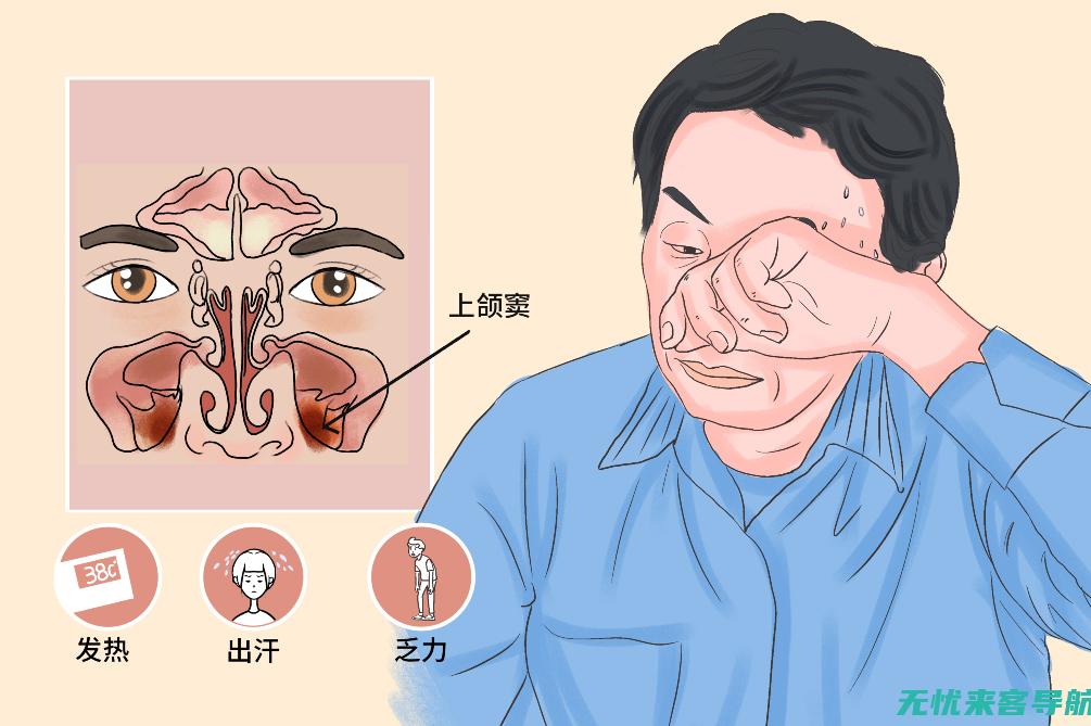 上颌窦炎是什么